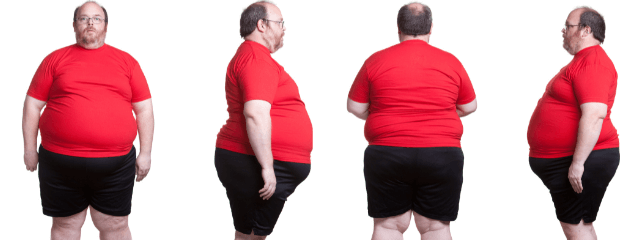 4 puntos de vista de un cuerpo con obesidad